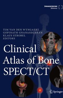 Clinical Atlas of Bone SPECT/CT