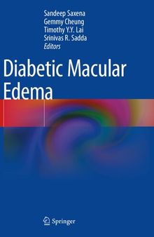 Diabetic Macular Edema