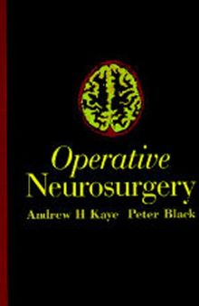 Operative Neurosurgery