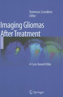 Imaging Gliomas After Treatment: A Case-based Atlas