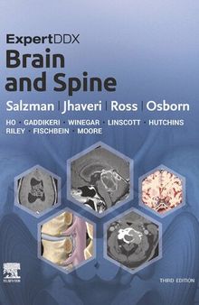 ExpertDDx: Brain and Spine