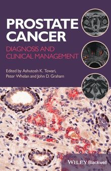 Prostate Cancer: Diagnosis and Clinical Management