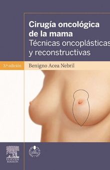Cirugía oncológica de la mama: Técnicas oncoplásticas y reconstructivas