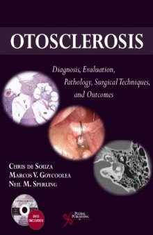 Otosclerosis: Diagnosis, Evaluation, Pathology, Surgical Techniques, and Outcomes