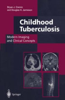 Childhood Tuberculosis: Modern Imaging and Clinical Concepts