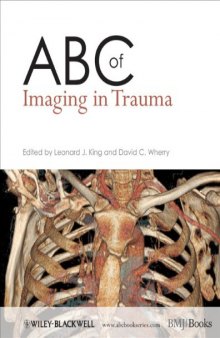 ABC of imaging in trauma