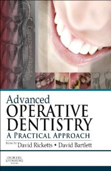 Advanced Operative Dentistry