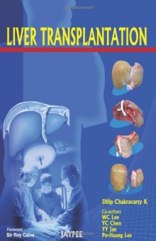 Liver Transplantation