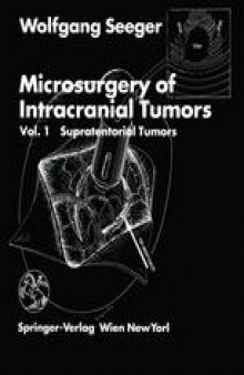 Microsurgery of Intracranial Tumors: Vol 1: Supratentorial Tumors