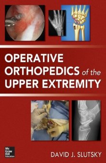 Operative Orthopedics of the Upper Extremity