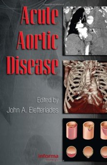 Acute aortic disease