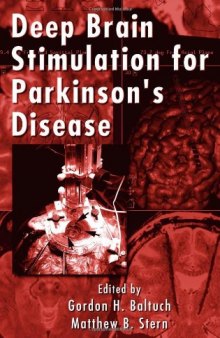 Deep Brain Stimulation for Parkinson's Disease