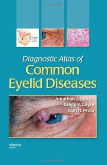 Diagnostic Atlas of Common Eyelid Diseases Informa Healthcare
