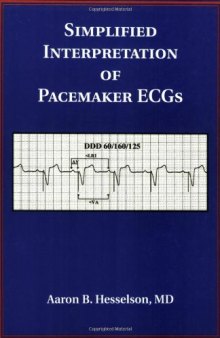 Simplified Interpretation of Pacemaker ECGs: An Introduction