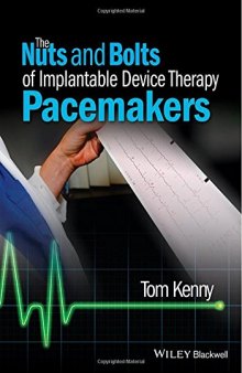 The nuts and bolts of implantable device therapy : pacemakers