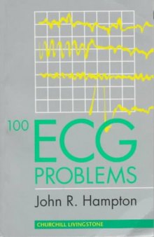 100 EKG Problems
