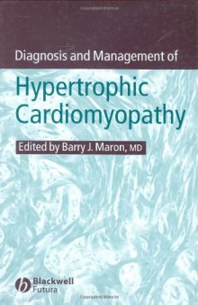 Diagnosis and Management of Hypertrophic Cardiomyopathy