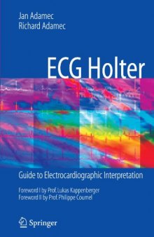 ECG Holter: Guide to Electrocardiographic Interpretation
