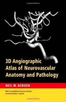 3D Angiographic Atlas of Neurovascular Anatomy and Pathology