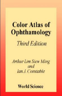 Colour Atlas of Ophthalmology