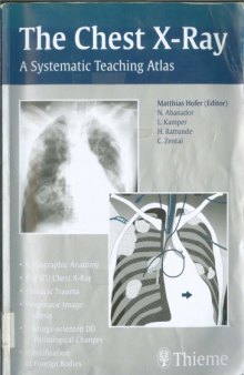 The Chest X-Ray-The Systematic Teaching Atlas.
