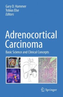 Adrenocortical Carcinoma: Basic Science and Clinical Concepts