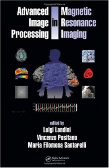 Advance image processing in magnetic resonance imaging