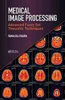 Medical image processing : advanced fuzzy set theoretic techniques
