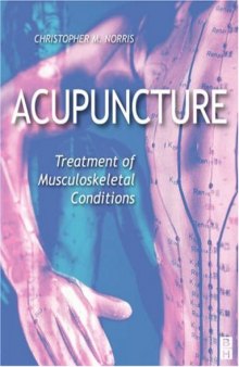 Acupuncture: treatment of musculoskeletal conditions