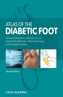 Atlas of the Diabetic Foot, 2nd edition