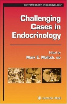 Challenging Cases in Endocrinology (Contemporary Endocrinology)