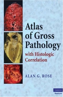 Atlas of Gross Pathology: With Histologic Correlation