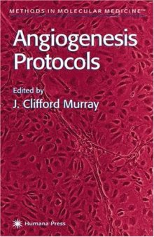 Angiogenesis Protocols (Methods in Molecular Medicine)