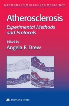 Atherosclerosis: Experimental Methods and Protocols (Methods in Molecular Medicine)