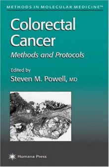 Colorectal Cancer: Methods and Protocols (Methods in Molecular Medicine)
