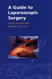 A guide to laparoscpic surgery