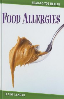 Food Allergies 