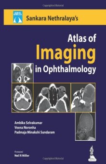 Sankara Nethralaya Atlas of Imaging in Ophthalmology