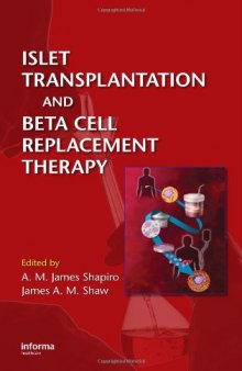 Islet Transplantation and Beta Cell Replacement Therapy