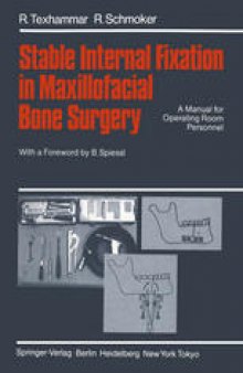 Stable Internal Fixation in Maxillofacial Bone Surgery: A Manual for Operating Room Personnel