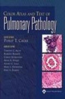 Color atlas and text of pulmonary pathology