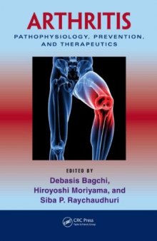Arthritis: Pathophysiology, Prevention, and Therapeutics  