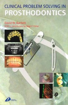 Clinical Problem Solving in Prosthodontics