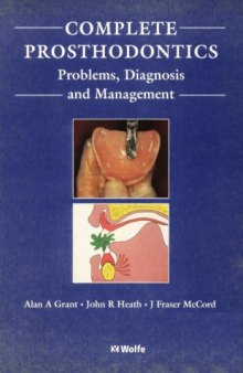 Complete Prosthodontics: Diagnosis and Management