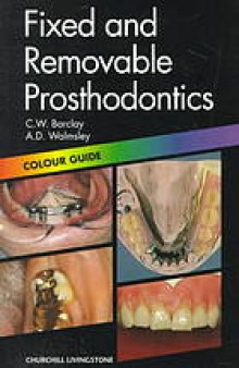 Fixed and removable prosthodontics : color guida