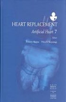 Heart replacement: artificial heart 7