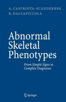 Abnormal Skeletal Phenotypes: From Simple Signs to Complex Diagnoses