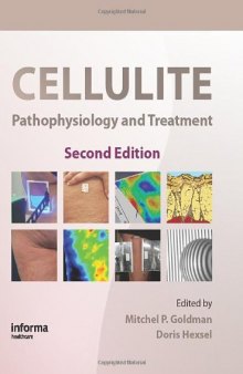 Cellulite: Pathophysiology and Treatment, 2nd Edition (Basic and Clinical Dermatology)