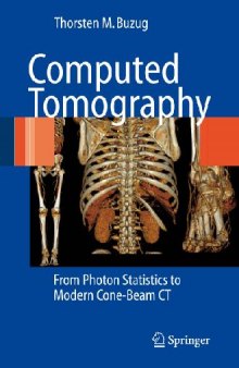 Computer Tomography - From Photon Statistics to Modern Cone-Beam CT