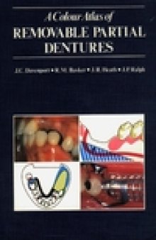 A Color Atlas of Removable Partial Dentures